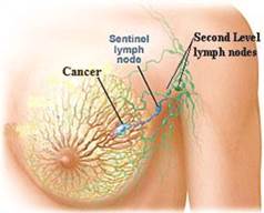 breast lymph.jpg