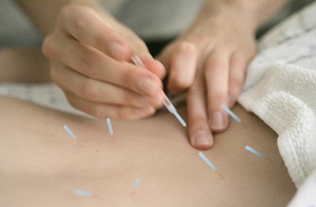 Anah McMahon, L. Ac. adjusts one inch seirin acupuncture needles in the muscles around the spine of Mariah VanHorn to relieve lower back pain, Monday, Sept. 24, 2007, at the Pacific College of Oriental Medicine in Chicago. Researchers at Ruhr University Bochum in Bochum, Germany, found that both real and fake acupuncture perform much better than conventional care for low back pain relief. 