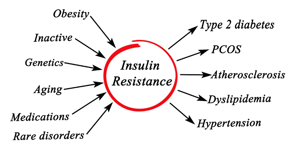 Diagram illustrating insulin resistance and the function of insulin in regulating blood sugar levels in the body.