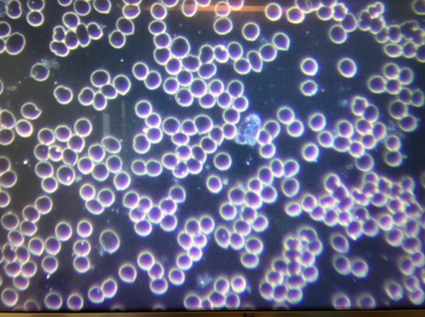 Microscopic image of healthy, well-separated red blood cells