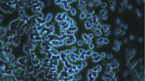 Microscopic image showing aggregated red blood cells with reduced separation.