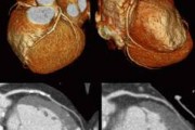 Calcification and Its Treatment with Magnesium and Sodium Thiosulfate